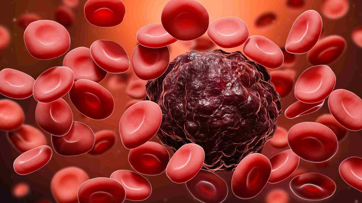 Blood Cancer: இரத்த புற்றுநோயின் ஆரம்பகால எச்சரிக்கை அறிகுறிகள் என்ன?